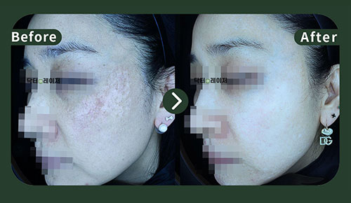 [기미] 40대 전후사진