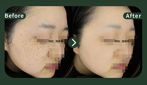 [기미] 20대 전후사진