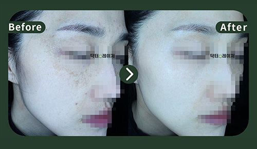 [기미] 40대 전후사진
